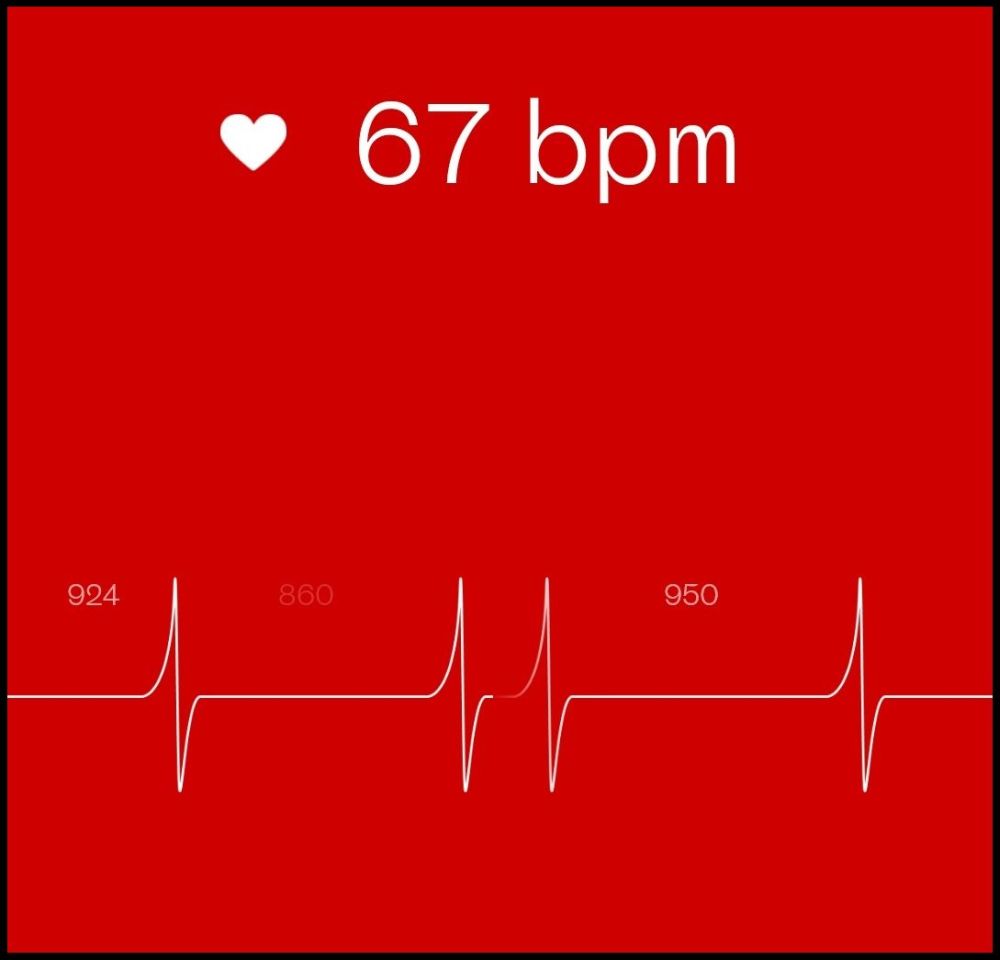So sieht eine Herzratenvariabilitätsmessung in Welltory aus.